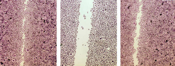 Dartsch study on the regeneration of connective tissue fibroblasts