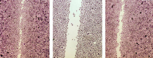 Dartsch study on the regeneration of connective tissue fibroblasts