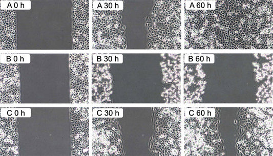 Protective effect of Qi-Shield on the regeneration of cultured connective tissue fibroblasts