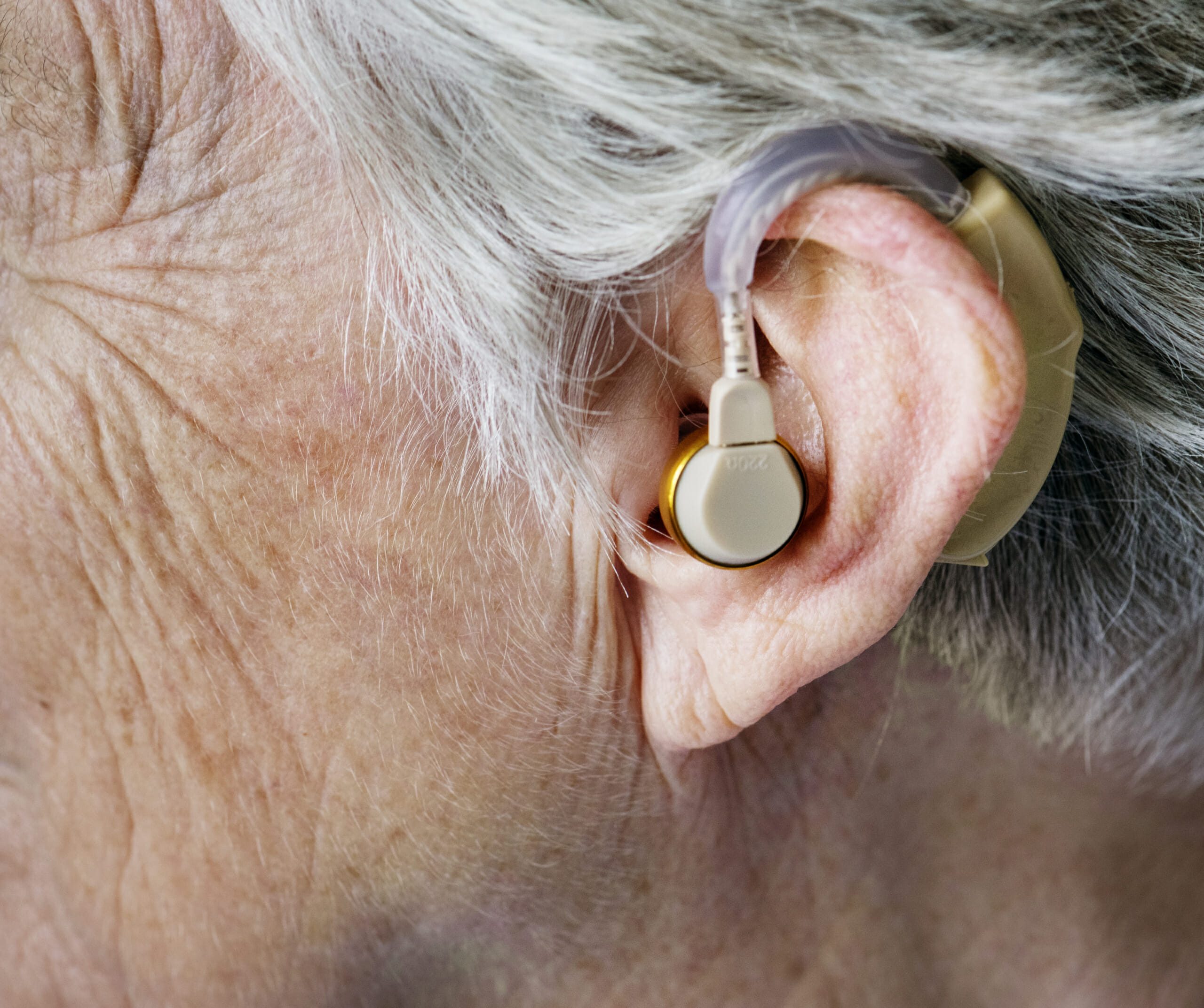 Elektrosmog durch Hörgeräte − Ist Ihre Gesundheit in Gefahr?