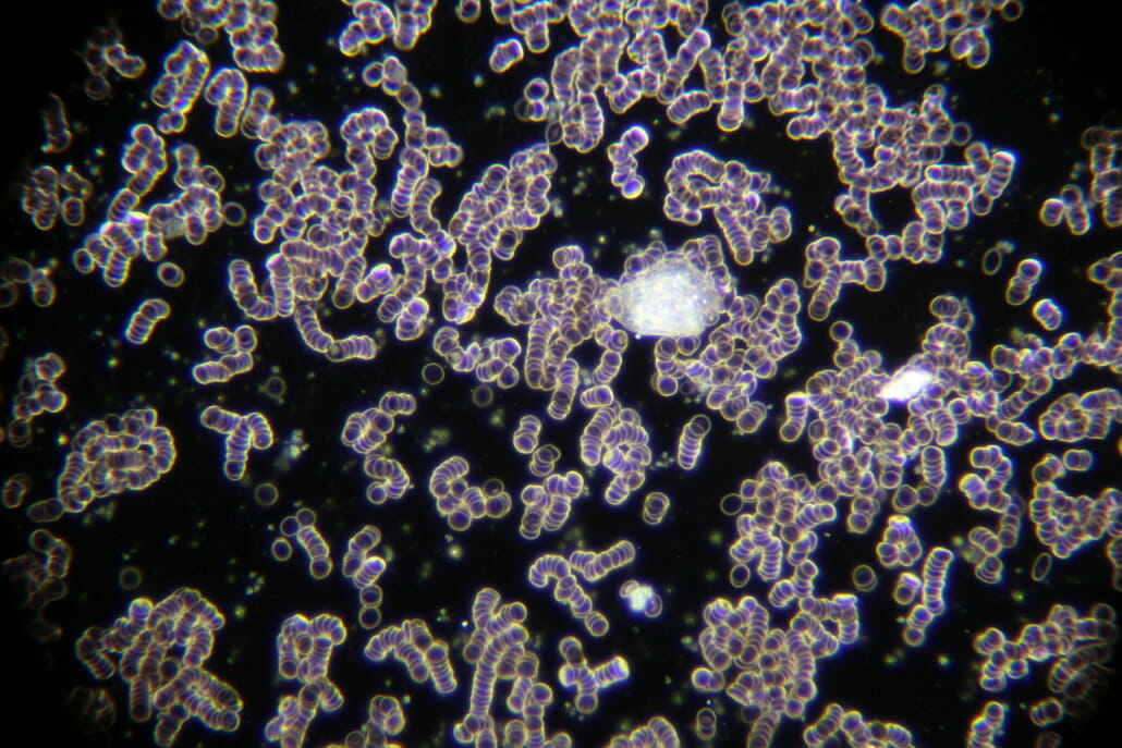 Geldrolleneffekt Dunkelfeldmikroskopie