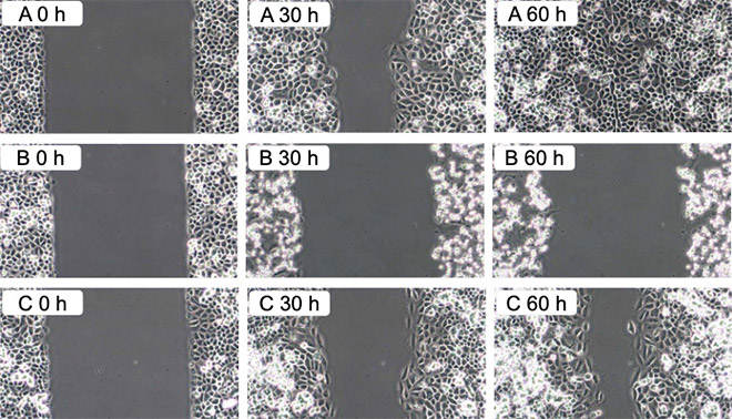 Schützende Wirkung von Qi-Shield auf die Regeneration kultivierter Bindegewebsfibroblasten